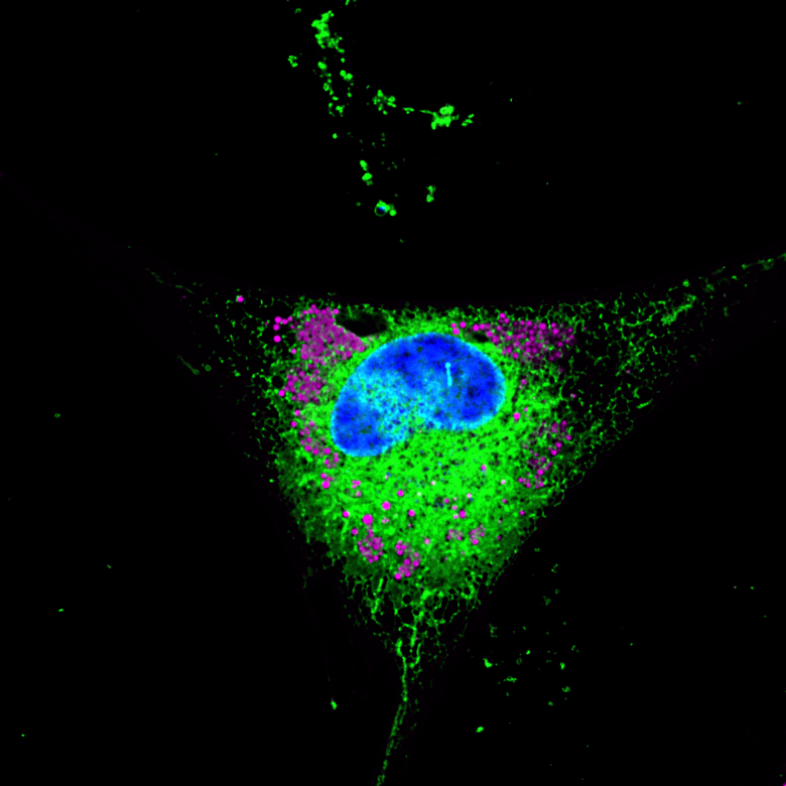 Astrocyte